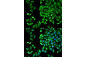 Immunofluorescence (IF) image for anti-WNK Lysine Deficient Protein Kinase 1 (WNK1) antibody (ABIN1875447)