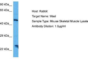 Host: Mouse Target Name: WASL Sample Tissue: Mouse Skeletal Muscle Antibody Dilution: 1ug/ml (Neural Wiskott-Aldrich syndrome protein (WASL) (Middle Region) Antikörper)