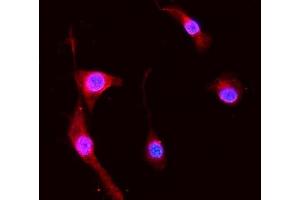 IF analysis of S100A8 using anti-S100A8 antibody (ABIN3042481). (S100A8 Antikörper  (AA 2-89))
