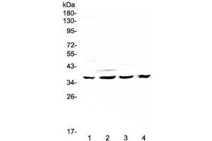 Western blot testing of human 1) HeLa, 2) SGC-7901, 3) K562 and 4) mouse SP2/0 lysate with Cdk6 antibody at 0. (CDK6 Antikörper  (AA 1-326))