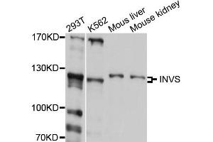 Western blot analysis of extract of various cells, using INVS antibody. (Inversin Antikörper)