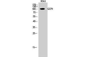 Western Blotting (WB) image for anti-Folate Hydrolase 1B (FOLH1B) (Internal Region) antibody (ABIN3175245) (FOLH1B Antikörper  (Internal Region))