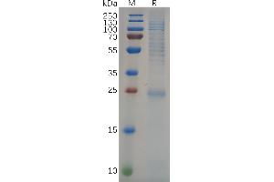 SDS-PAGE (SDS) image for GTPase Kras (KRAS) (AA 2-185) protein (His tag) (ABIN7092804)