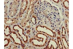 Immunohistochemistry of paraffin-embedded human kidney tissue using ABIN7147600 at dilution of 1:100 (CH25H Antikörper  (AA 142-272))