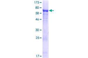 ALDH1L2 Protein (AA 1-488) (GST tag)