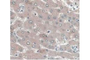 IHC-P analysis of Human Liver Tissue, with DAB staining. (UCP2 Antikörper  (AA 154-289))