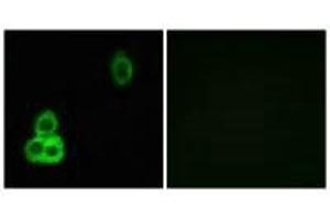 Immunofluorescence analysis of MCF-7 cells, using CELSR1 antibody. (CELSR1 Antikörper)