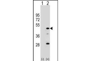 Western blot analysis of DAC (arrow) using rabbit polyclonal DAC Antibody (C-term) (ABIN390780 and ABIN2841034). (AADAC Antikörper  (C-Term))