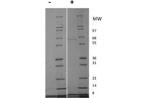 SDS-PAGE (SDS) image for Insulin-Like Growth Factor 1 (IGF1) protein (ABIN6699964)