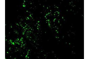 Formalin-fixed, paraffin-embedded human colon carcinoma stained with CF488-conjugated Nucleolin MAb (364-5 + NCL/902). (BrdU Antikörper  (CF®488A))