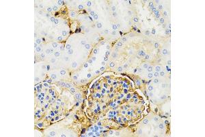 Immunohistochemistry of paraffin-embedded mouse kidney using GALT antibody. (GALT Antikörper)