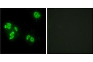 Immunofluorescence analysis of A549 cells, using TFIP8 Antibody  . (TNFAIP8 Antikörper)