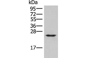 Western blot analysis of Human fetal brain tissue lysate using MRAS Polyclonal Antibody at dilution of 1:400 (MRAS Antikörper)