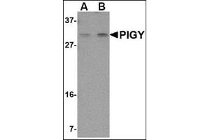 Western blot analysis of PIG-Y in human spleen tissue lysate with this product at (A) 1 and (B) 2 μg/ml. (PIGY Antikörper  (Center))
