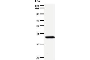 Western Blotting (WB) image for anti-Paired Box 6 (PAX6) antibody (ABIN930925)