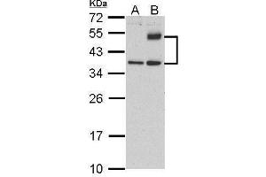 WB Image Sample (30 ug of whole cell lysate) A: HeLa (control)  B: HeLa treat tunicamycin (4ug/ml) 12% SDS PAGE antibody diluted at 1:500 (ATF4 Antikörper)