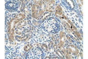 CRELD1 antibody was used for immunohistochemistry at a concentration of 4-8 ug/ml to stain Epithelial cells of renal tubule (arrows) in Human Kidney. (CRELD1 Antikörper  (C-Term))