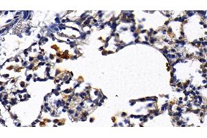 Immunohistochemistry (IHC) image for anti-Interleukin 1 Receptor, Type I (IL1R1) (AA 21-109) antibody (ABIN7430735)