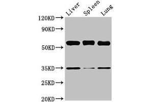 Western Blot Positive WB detected in: Mouse liver tissue, Mouse spleen tissue, Mouse lung tissue All lanes: Gba antibody at 3. (GBA Antikörper  (AA 20-515))