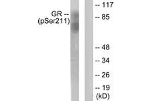 Western blot analysis of extracts from HeLa cells treated with Heat shock, using GR (Phospho-Ser211) Antibody. (GR (AA 181-230), (pSer211) Antikörper)