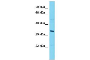 Host: Rabbit  Target Name: Eapp  Sample Tissue: Rat Thymus lysates  Antibody Dilution: 1. (EAPP Antikörper  (N-Term))