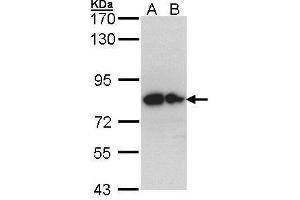 WB Image Sample (30 ug of whole cell lysate) A: Hep G2 , B: Molt-4 , 7. (GPC1 Antikörper)