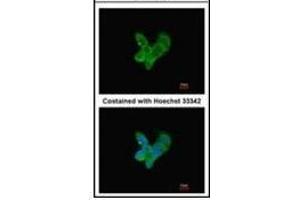 Immunofluorescence analysis of methanol-fixed HepG2, using Complement C9 antibody at 1/200 dilution. (C9 Antikörper)