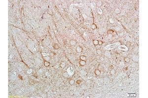 Immunohistochemistry (Paraffin-embedded Sections) (IHC (p)) image for anti-Nitric Oxide Synthase 1, Neuronal (NOS1) (AA 51-150) antibody (ABIN725585) (NOS1 Antikörper  (AA 51-150))