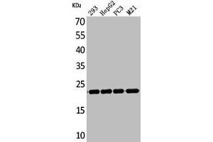 Western Blot analysis of 293 HepG2 PC-3 M21 cells using FGF-6 Polyclonal Antibody (FGF6 Antikörper  (C-Term))