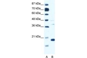 Western Blotting (WB) image for anti-Calcium Channel, Voltage-Dependent, gamma Subunit 1 (CACNG1) antibody (ABIN2461569)