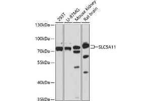 Western blot analysis of extracts of various cell lines, using SLC5 antibody (ABIN6127283, ABIN6148021, ABIN6148022 and ABIN6217058) at 1:3000 dilution.