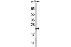Western blot analysis of NQO2 Antibody (Center) in mouse liver tissue lysates (35ug/lane). (NQO2 Antikörper  (Middle Region))