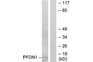 Western blot analysis of extracts from RAW264. (PFDN1 Antikörper  (AA 1-50))