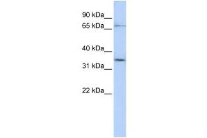 Western Blotting (WB) image for anti-Solute Carrier Organic Anion Transporter Family, Member 1C1 (SLCO1C1) antibody (ABIN2458796) (SLCO1C1 Antikörper)