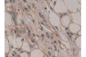 Immunohistochemistry (IHC) image for anti-ATPase, Na+/K+ Transporting, beta 3 Polypeptide (ATP1B3) (AA 61-273) antibody (ABIN7440134)
