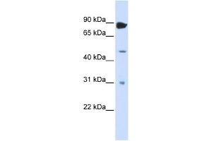 ADARB1 antibody used at 1 ug/ml to detect target protein. (RED1 Antikörper)