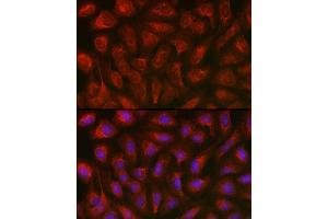 Immunofluorescence (IF) image for anti-Thioredoxin Interacting Protein (TXNIP) (AA 1-166) antibody (ABIN6149733)