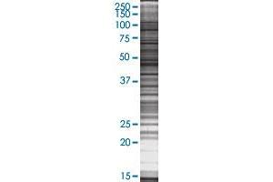 IL2RG transfected lysate. (IL2RG 293T Cell Transient Overexpression Lysate(Denatured))