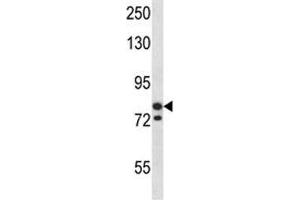 MCM3 antibody western blot analysis in SK-BR-3 lysate. (MCM3 Antikörper  (AA 36-64))