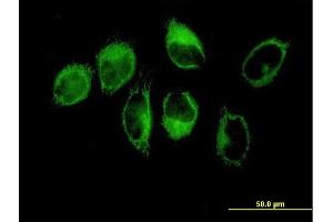 Immunofluorescence of purified MaxPab antibody to THBS1 on HeLa cell. (Thrombospondin 1 Antikörper  (AA 1-1170))