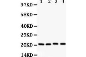 Western Blotting (WB) image for anti-Caveolin 1, Caveolae Protein, 22kDa (CAV1) (AA 4-178) antibody (ABIN3043803)