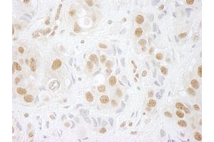 Immunohistochemistry (IHC) image for anti-hPrp3p (AA 100-150) antibody (ABIN7448600) (hPrp3p (AA 100-150) Antikörper)