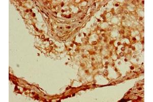 Immunohistochemistry of paraffin-embedded human testis tissue using ABIN7166156 at dilution of 1:100 (SSX1 Antikörper  (AA 112-188))