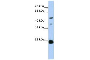 ZDHHC14 antibody used at 1 ug/ml to detect target protein. (ZDHHC14 Antikörper  (N-Term))