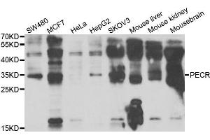 Western blot analysis of extracts of various cell lines, using PECR antibody. (PECR Antikörper)