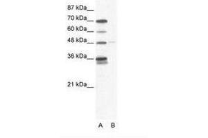 Image no. 1 for anti-GLIS Family Zinc Finger 2 (GLIS2) (AA 83-132) antibody (ABIN202714) (GLIS2 Antikörper  (AA 83-132))
