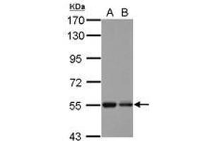 Image no. 1 for anti-Kelch Repeat and BTB (POZ) Domain Containing 4 (KBTBD4) (AA 287-518) antibody (ABIN1501896) (KBTBD4 Antikörper  (AA 287-518))