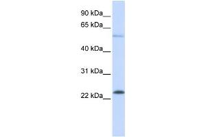 Western Blotting (WB) image for anti-GTPase Kras (KRAS) antibody (ABIN2459898) (K-RAS Antikörper)