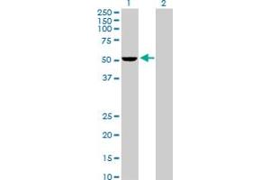 Western Blot analysis of PSMD5 expression in transfected 293T cell line by PSMD5 MaxPab polyclonal antibody. (PSMD5 Antikörper  (AA 1-504))