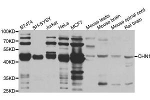 Western blot analysis of extracts of various cell lines, using CHN1 antibody. (CHN1 Antikörper  (AA 1-200))